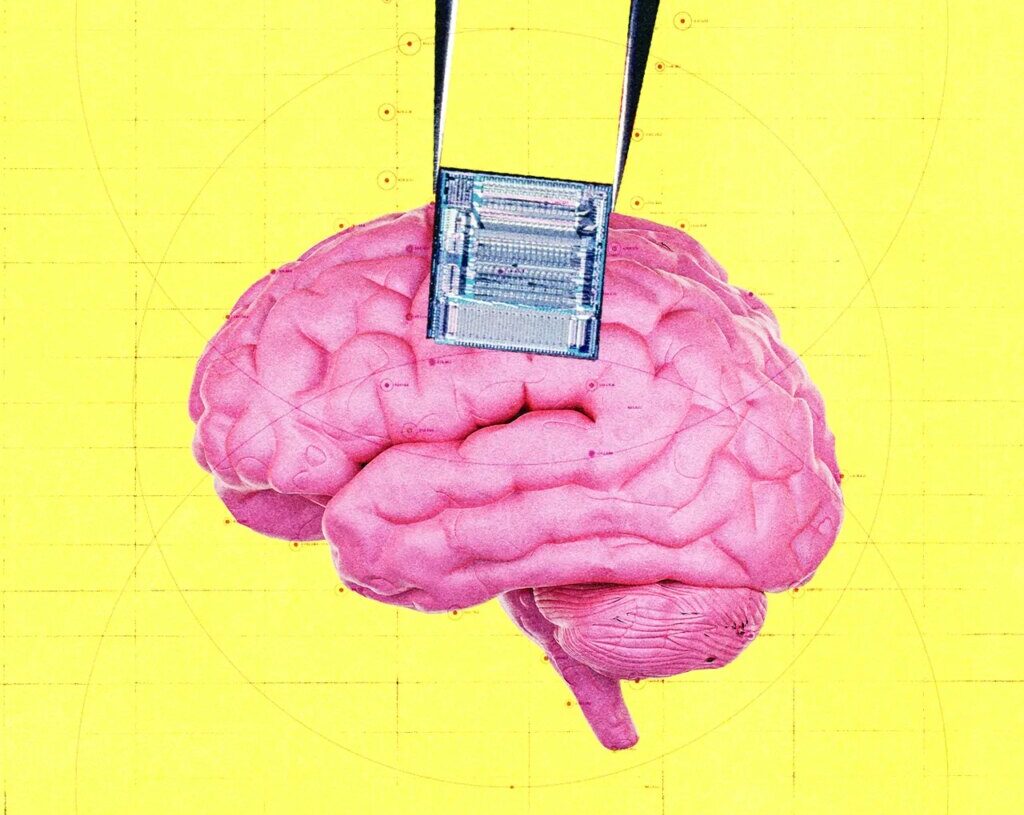 OpenAI Invests in Startup That Uses Brain Implants to Detect Cancer