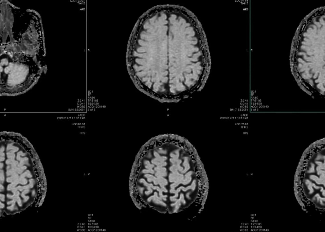 What Your Word Choices Reveal About Psychopathic Traits, According to a New Study