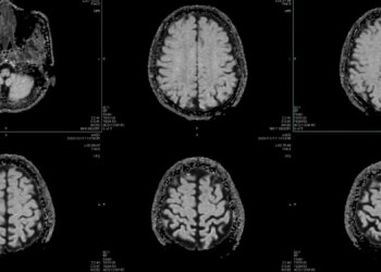 What Your Word Choices Reveal About Psychopathic Traits, According to a New Study