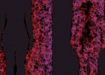 How Evolution Might Have Given Us Autoimmune Diseases