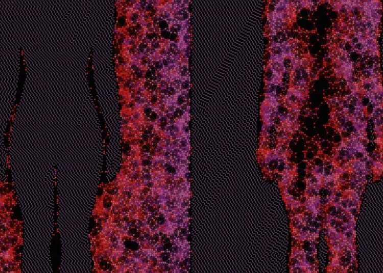 How Evolution Might Have Given Us Autoimmune Diseases