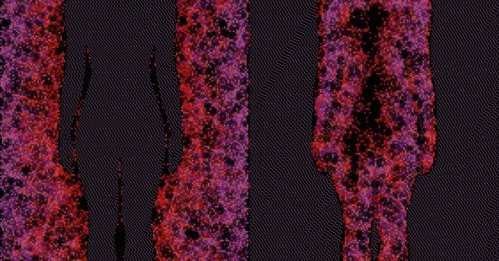 How Evolution Might Have Given Us Autoimmune Diseases