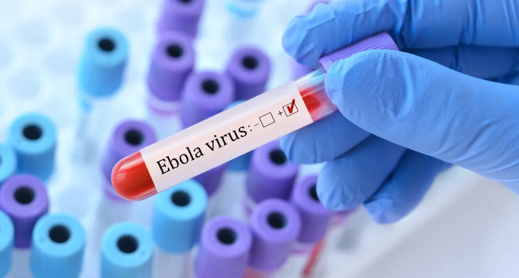 A doctor holds a blood sample tube for an Ebola virus test.