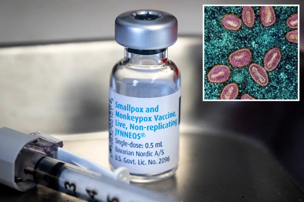 Mpox outbreak hits California county as health officials probe US spread