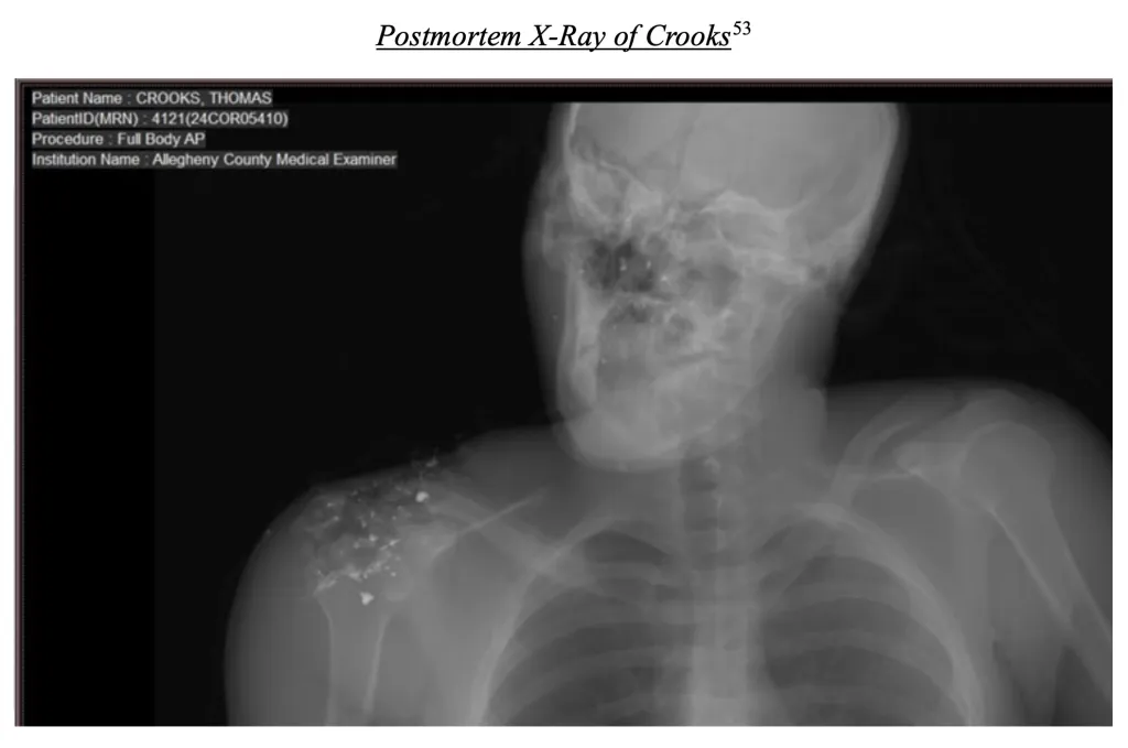 Postmortem X-ray of Thomas Crooks showing retained bullet fragments in the head, neck, and right shoulder.