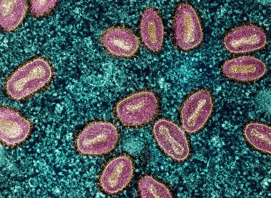 Colorized transmission electron micrograph of mpox virus particles within an infected cell.
