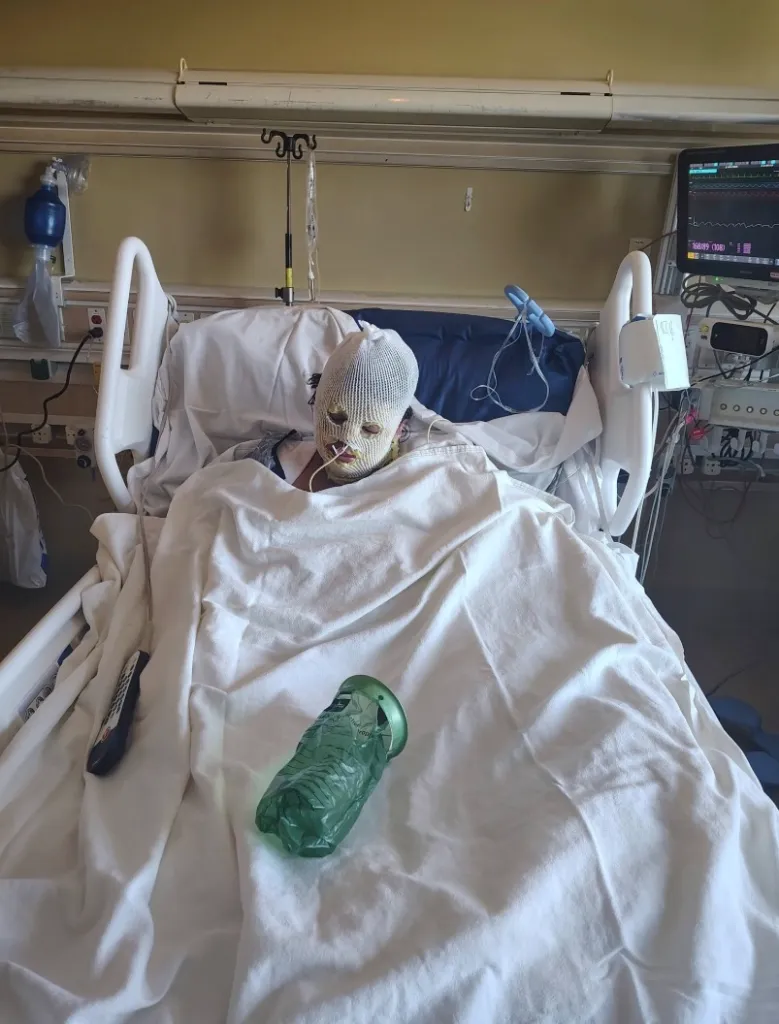 Frances Lopez recovering in a hospital bed with her head and face wrapped in bandages.