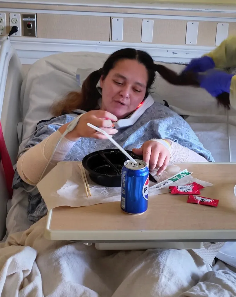 Frances Lopez in a hospital bed, eating with her arms bandaged.