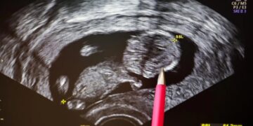 The dark side of optimizing fertility