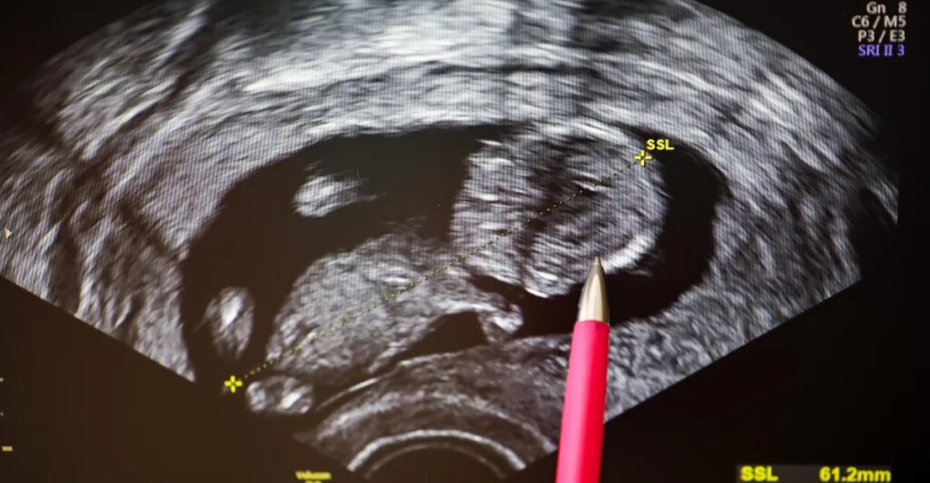 The dark side of optimizing fertility