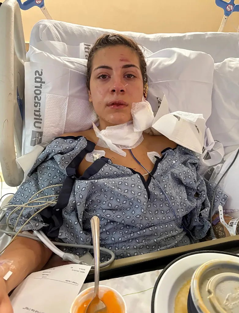 Olivia Neri, a NY college student, was hospitalized after she was slashed by a coworker as she drove him home on Oct. 9, 2026.