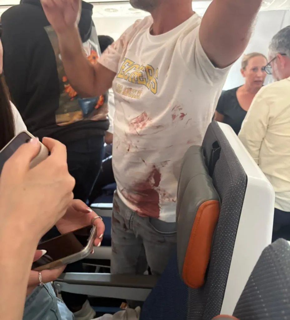 A passenger with bloodstains on his clothes aboard a Flydubai commercial flight from Dubai to Tel Aviv.