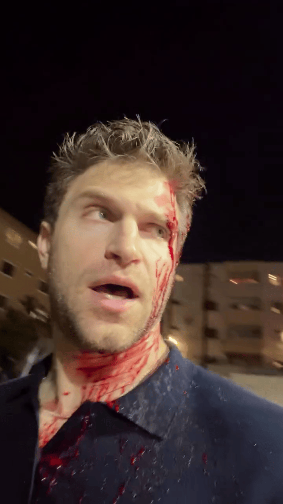 Keegan Allen with blood on his face and neck.