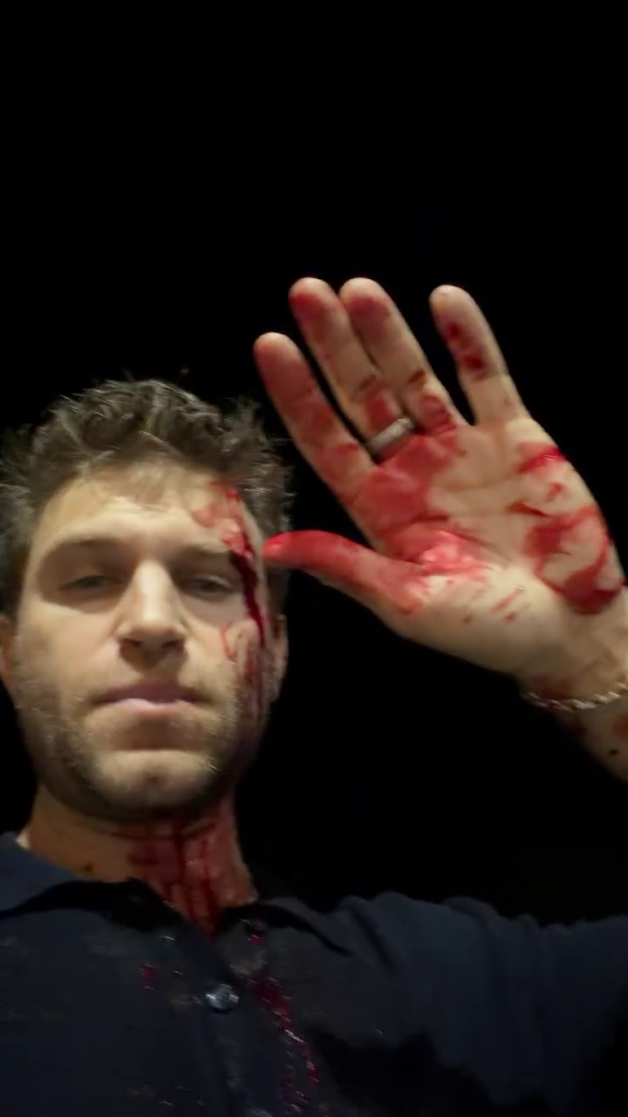 Keegan Allen is covered in blood after being attacked in West Hollywood.
