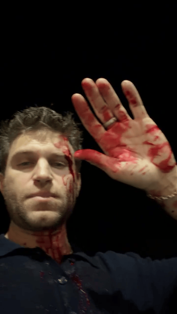 Actor Keegan Allen is covered in blood after being attacked.