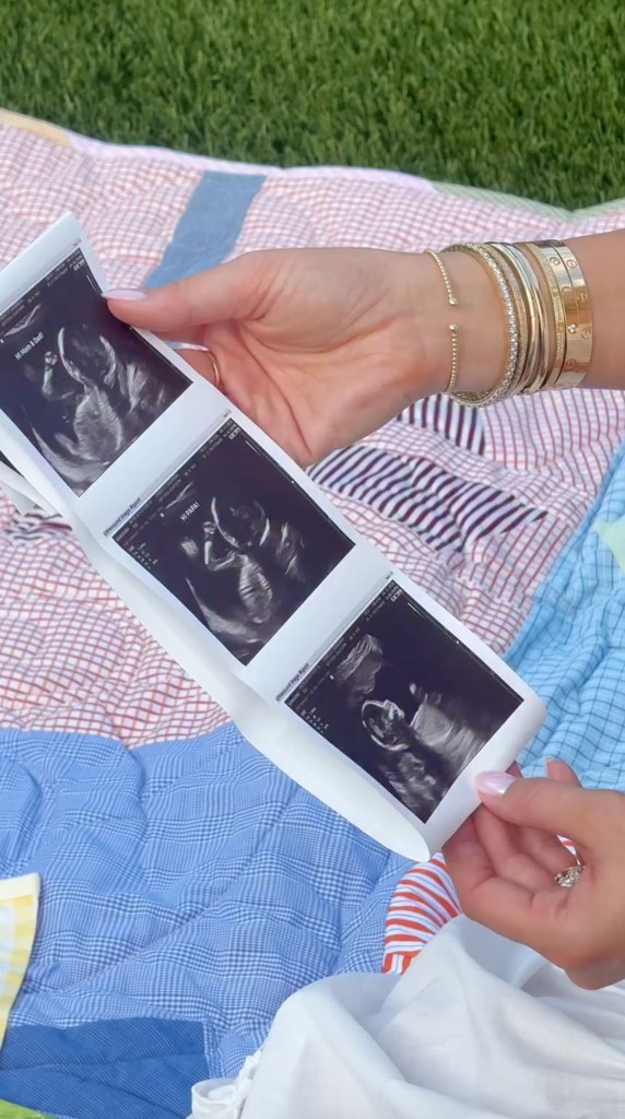 A person holding a strip of three ultrasound images.