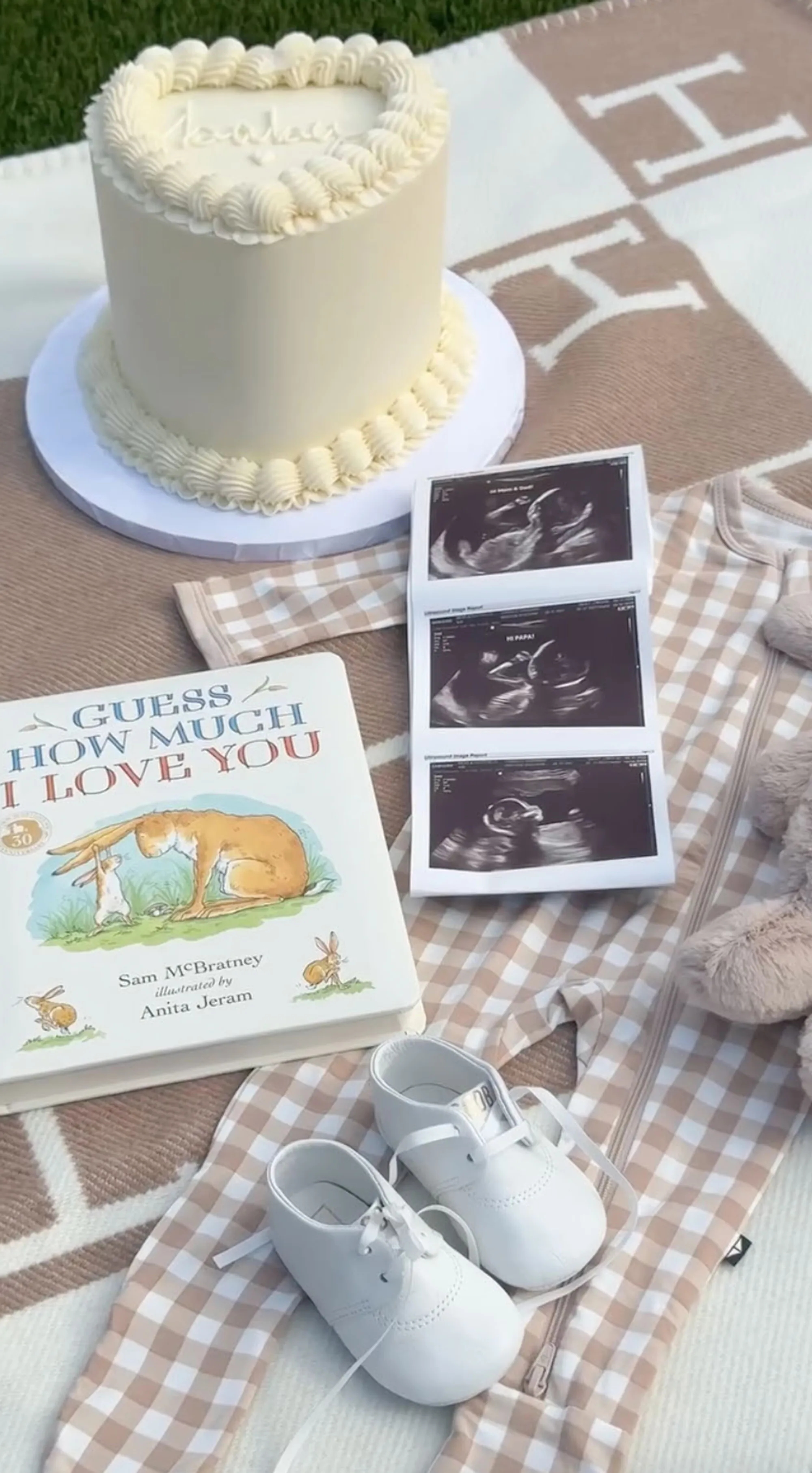 A white frosted cake, an ultrasound scan, the book 