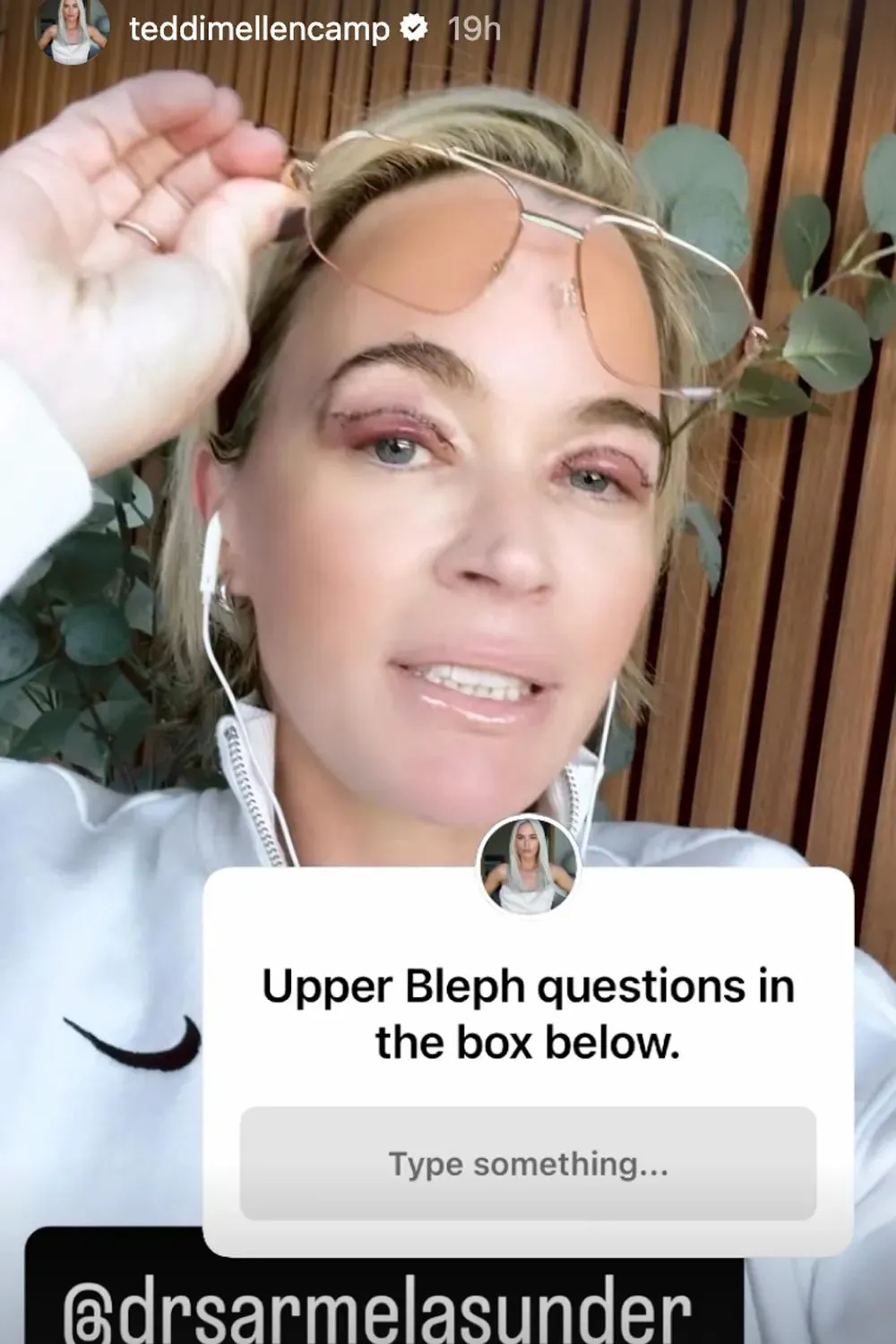 Teddi Mellencamp poses for a selfie while wearing glasses on her forehead and showing her healing eyelids after an upper blepharoplasty.