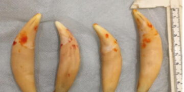 Anaheim couple trafficked endangered wildlife parts, including bear gallbladders and lion teeth, feds say