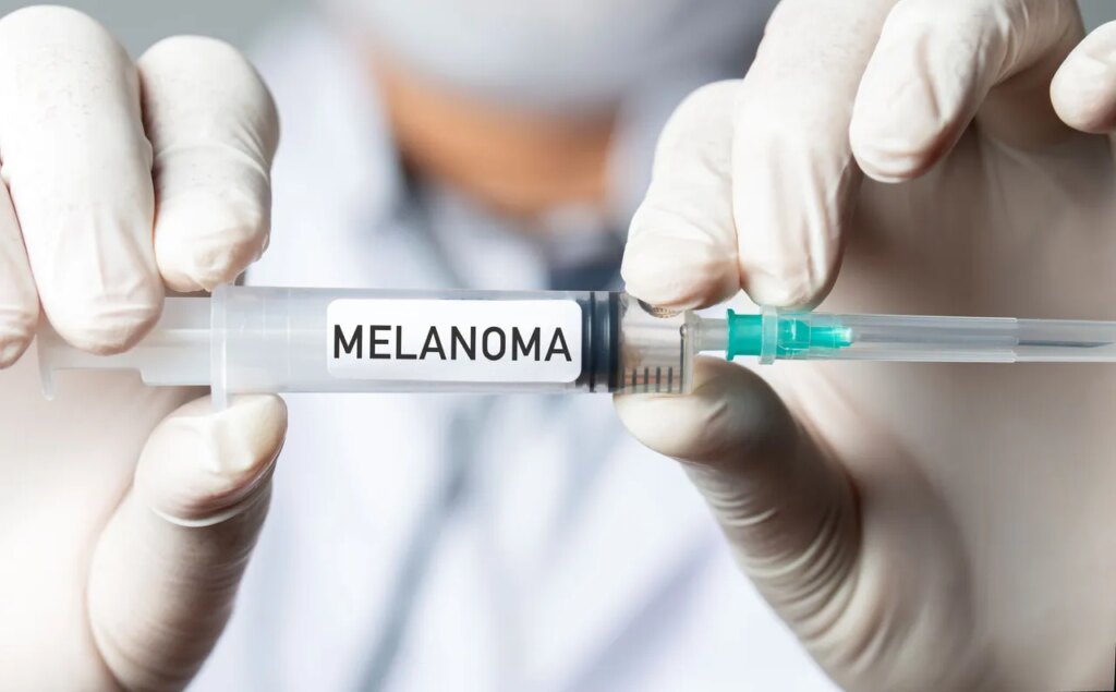 New mRNA Vaccine Reduces Risk of Melanoma Recurrence by Over 40 Percent
