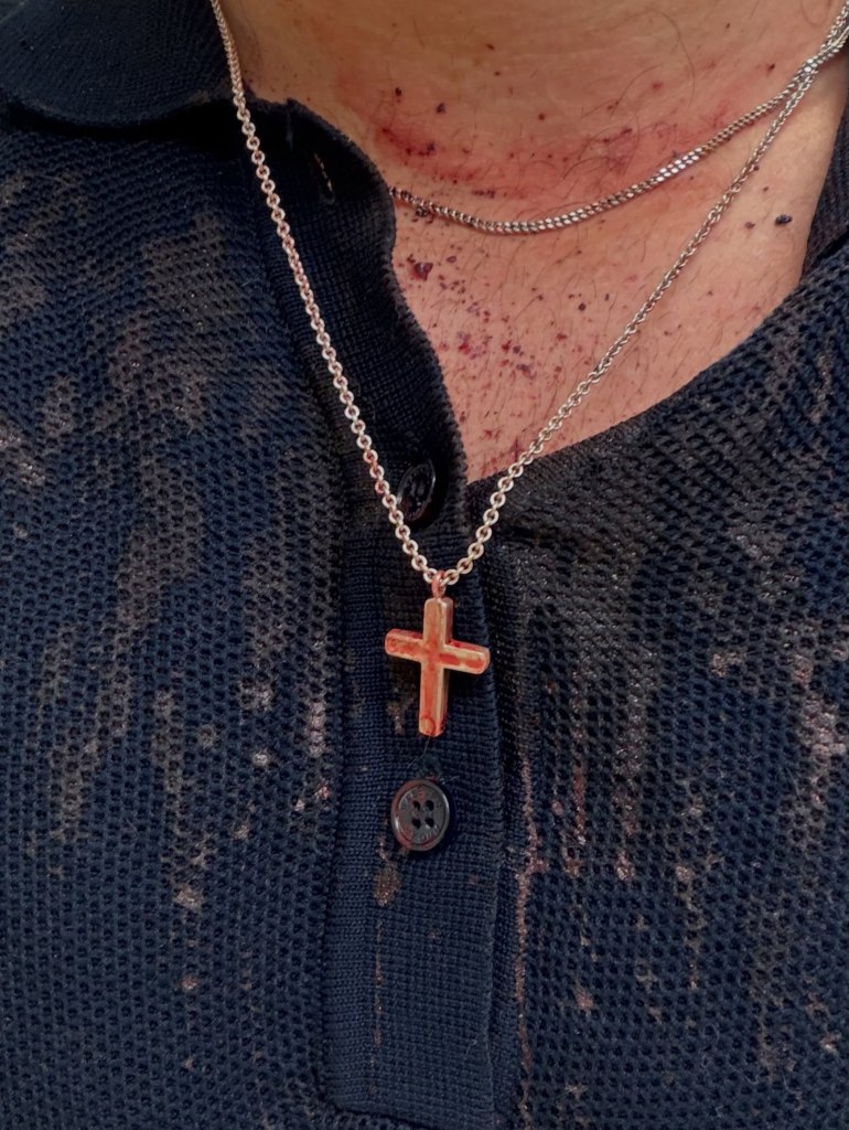 Keegan Allen wearing a cross necklace, with injuries and blood visible on his neck and chest following an attack.