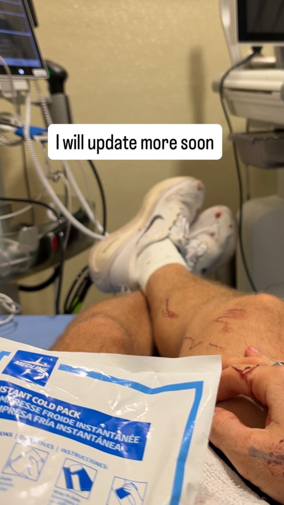 Keegan Allen in a hospital room with scratches on his legs and hand, holding a cold pack, with the text 